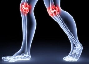 The reasons for the development of illegal knee