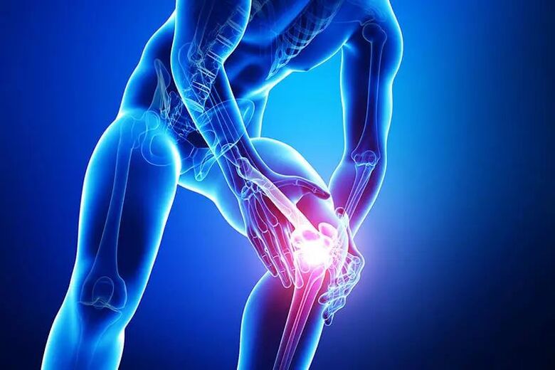 symptoms of osteoarthritis